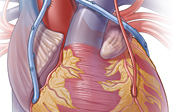 Coronary Artery Bypass Medical Illustration