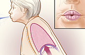 Pursed Lip Breathing Medical Illustration