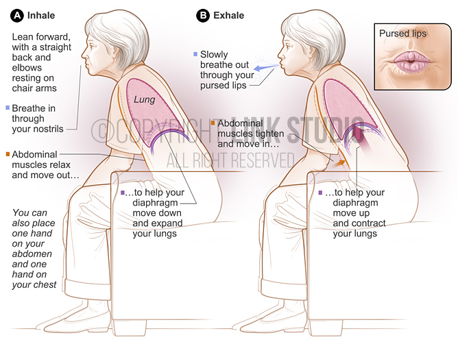 Pursed-lip breathing medical illustration
