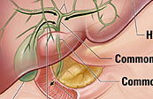 Liver biliary drainage medical illustration