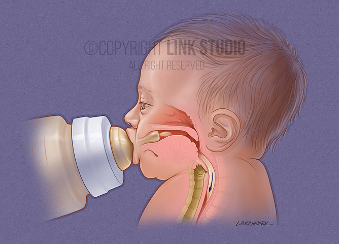 Normal infant swallow medical illustration