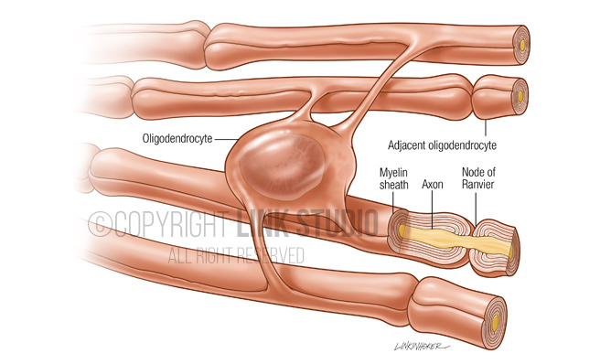 Oligodendrocyte medical illustration