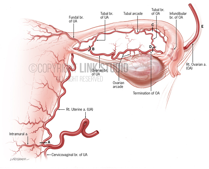 Ovarian arteries medical illustration