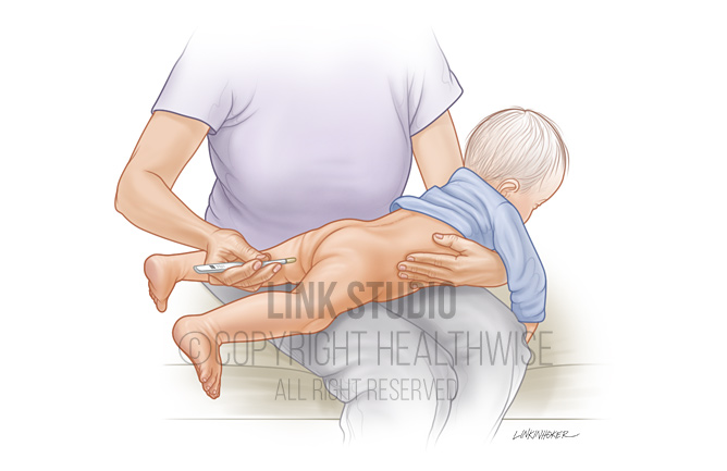 Taking a rectal temperature illustration