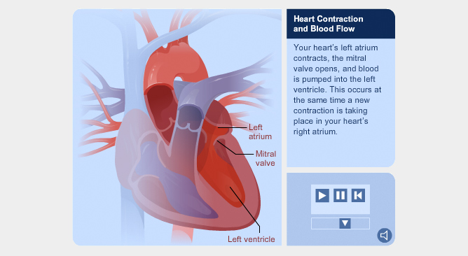 Heart & Coronary Artery Diseases - Link Studio - Medical Animation