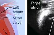 Cardiac echocardiography medical animation