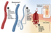 Johns Hopkins Cystic Fibrosis teen website CFTR gene