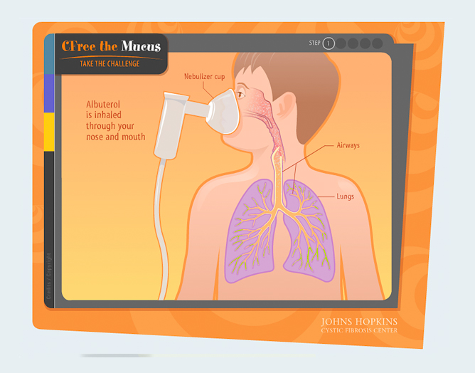 Johns Hopkins Cystic Fibrosis animation