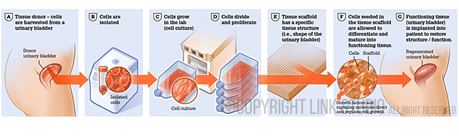 Tissue Engineering Medical Illustration