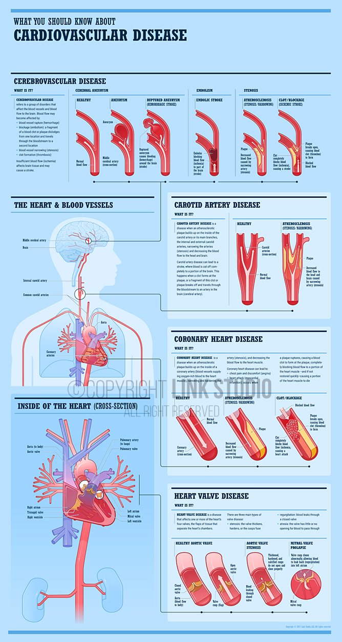 Graphic Anatomy - Cardiovascular Disease